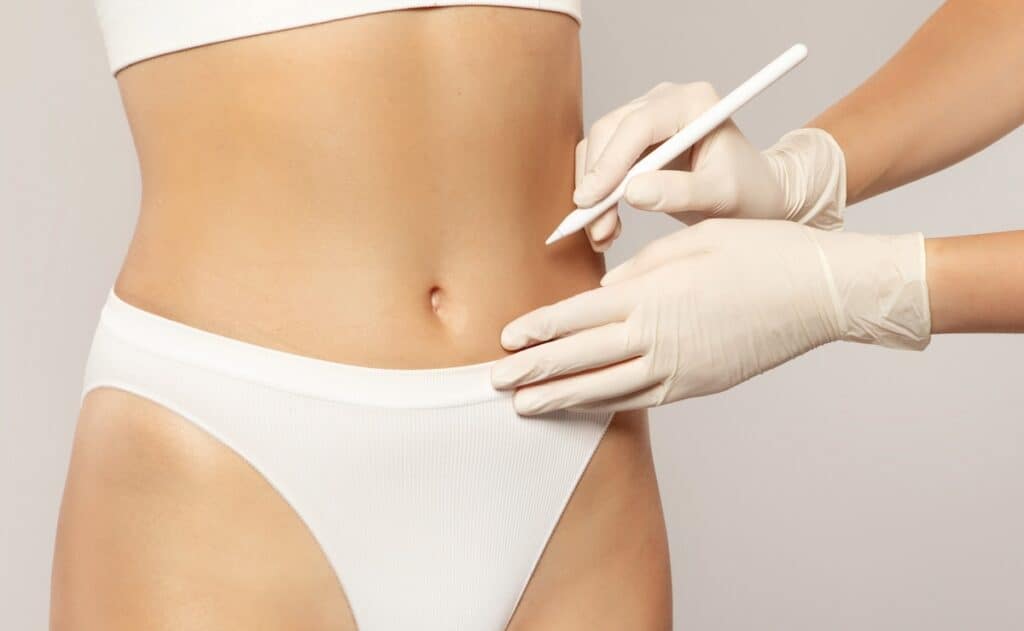 Liposuction