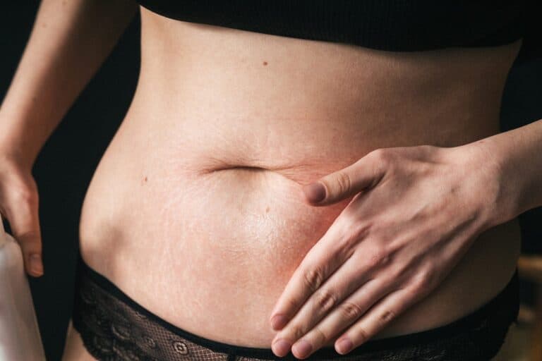 woman with fat belly