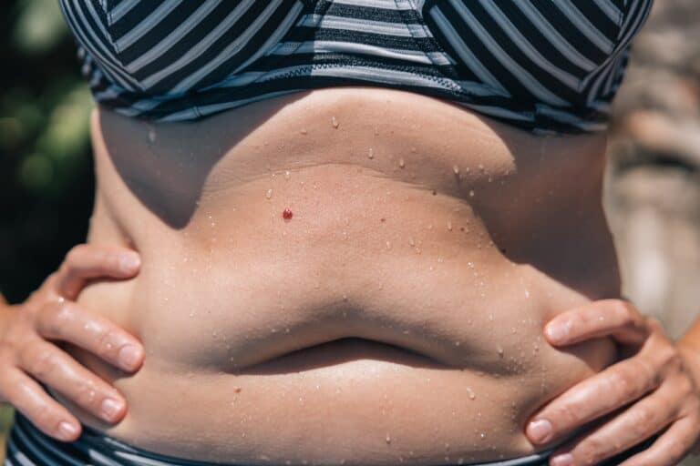 overweight woman with fat belly
