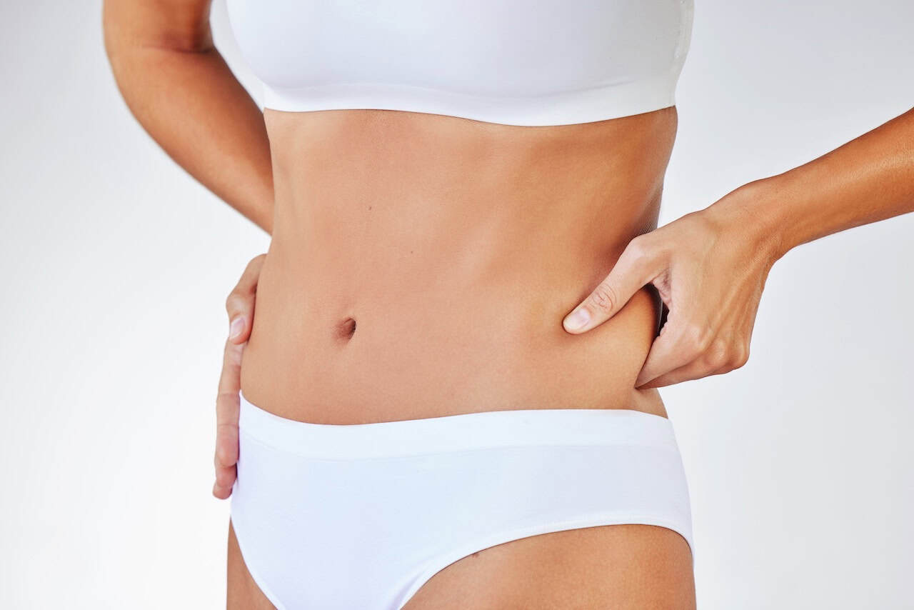 Tummy Tuck
